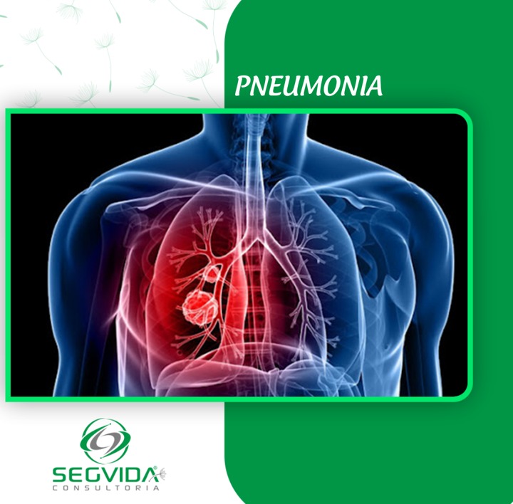 Sintomas de pneumonia: quais são, diagnóstico e tratamento